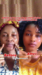 Brazilian Cream That Makes Us Look Younger