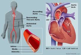The heart is like a pump that sends blood around your body. Aorta Picture Image On Medicinenet Com