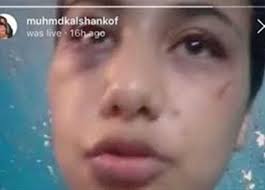 مشاهدة وتحميل جميع حلقات مسلسل الاختيار 2: Ø§Ù„Ø·Ø§Ù„Ø¨ÙŠØ© Ø´Ù‡Ø¯Øª Ø§Ù„ÙˆØ§Ù‚Ø¹Ø© Ø§Ù„ØªØ­Ø±ÙŠØ§Øª ØªÙƒØ´Ù Ù…Ù„Ø§Ø¨Ø³Ø§Øª Ù…ÙˆØ§Ù‚Ø¹Ø© ÙØªØ§Ø© Ø§Ù„ØªÙŠÙƒ ØªÙˆÙƒ Ø¬Ù†Ø³ÙŠ Ø§ ÙƒØ±Ù‡ Ø§ Ø¹Ù†Ù‡Ø§ Ø§Ù„Ù…ØµØ±ÙŠ Ø§Ù„ÙŠÙˆÙ…