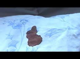 How do you get rid of old dried blood stains? How To Remove Blood Stains From Your Sheets Clothes On Whirlpool Washing Machine Youtube