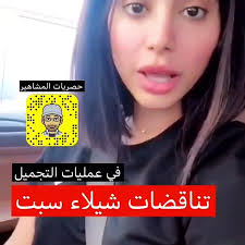 شيلاء سبت قبل عمليات التجميل. ØªÙ†Ø§Ù‚Ø¶Ø§Øª Ø´ÙŠÙ„Ø§Ø¡ Ø³Ø¨Øª Ø­ÙˆÙ„ Ø­Ù‚ÙŠÙ‚Ø© Ø®Ø¶ÙˆØ¹Ù‡Ø§ Ù„Ù„ØªØ¬Ù…ÙŠÙ„ ÙÙŠØ¯ÙŠÙˆ Dailymotion