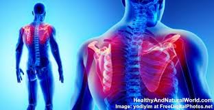 Maybe you would like to learn more about one of these? Pinched Nerve In Shoulder Symptoms Causes And Effective Treatments