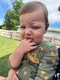 I got my first phone call from my son today from bootcamp. He says he wants  to quit and come home. He said he is sick and he has pink eye. It