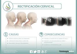 Se dice que la fisioterapia posee un gran número de. La Rectificacion Cervical Que Es Y A Que Se Debe Esta Disfuncion