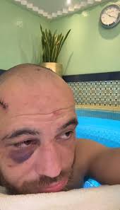 🇧🇷🗣️Jean Silva wants to face Yair Rodriguez in December: “Diego Lopes  Was Sinister, Capitalized, Showed Off... Now I'M Going To Stay Quiet And  Listen (Laughs). But You Can Bet That Our Paths