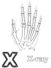 X ray fish coloring pages. X Is For X Ray Coloring Page Coloring Home