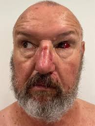 Cameron Welsh: Huge legal twist for man who assaulted prison officers