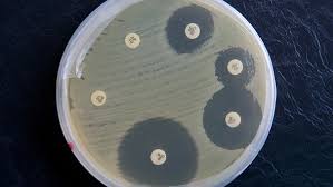 Penicillin wirkt vor allem gegen grampositive bakterien (wie streptokokken) und gegen einige gramnegative bakterien (wie meningokokken). Antibiotika Fluch Oder Segen Bayern 2 Radio Br De