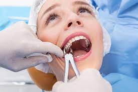 How to prepare for my wisdom teeth removal. Wisdom Teeth Surgery How Is It Done And What To Do After