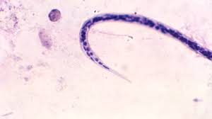 Image result for Oncocalyx bolusii