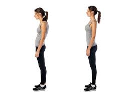 Chief among them are core strengthening exercises, which are essential to maintaining healthy upright posture. Swayback Posture Risks And Treatment