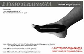 Pin En Cinta Kinesiologica