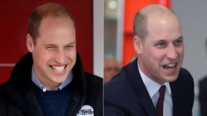 Prince William's Hair Transformation Totally Changed His Look Over The Years