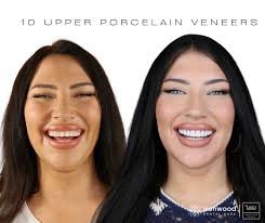 This smile transformation is all about bold and bright! ✨ She had a gap  between her teeth and a missing tooth