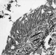 The epithelioid, sarcomatoid and biphasic types (8). Http Eknygos Lsmuni Lt Springer 266 Part 20six 6 20item Pdf