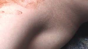 Bildergebnis für Thunska Pansittivorakul