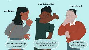 End-Stage Copd: Symptoms, Causes, And Coping