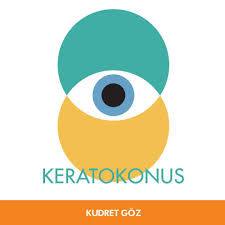 Ailede Bir Keratokonus Hastasi Varsa Ozellikle Dikkat Edilmelidir Cunku Keratokonusta Genetik Faktor Onemli Rol Oynamaktadir Kudretgoz Goz Hastane Saglik