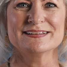 Photos-I Love My White Hair