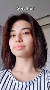 Gözəl pasientimin çəkdiyi bu pozitiv videonu paylaşaraq hər birinizə xoş  istirahətlər arzu edirəm 🥰, Üzüm, Sizləri güldürdükcə gülür!,  #uzmanortodont #heftesonu #pozitiv #iyieğlenceler ...