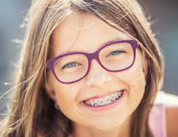 Your teeth may feel loose while they align: 6 Ways To Keep Teeth Clean With Braces Dr L Tanya Joy Bailey Dds