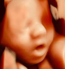 Donna Gilchrist Baby Scan Studio