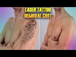 Tattoo shops commonly charge by the hour, with quality artists generally charging how much will it cost me to have a rose tatoo on ma leg? Laser Tattoo Removal Cost Update 2021 What Should You Know Before Treatment