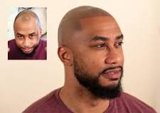 Image result