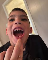 anna.salmon.507 I love maiz balls ❤️