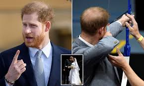 Prince Harry 'underwent thickening ...