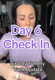 Moving right along! Tummy tuck post op day 6!