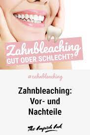 zahnbleaching vor und nachteile zahnbleaching weisse zahne zahnkosmetik