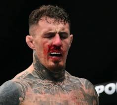 Ankles, knees and eyes oh my this dude is wack.