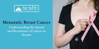 Recurrent breast cancer is breast cancer that comes back after initial treatment. Metastatic Breast Cancer Understanding The Spread And Recurrence Of Cancer In Breasts