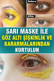 Sari Maske Ile Goz Alti Siskinlik Ve Kararmalarindan Kurtulun 2020 Maskeler Yaslanma Dogal Cilt