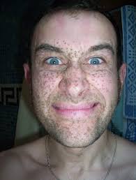 Alexandre YAGER (PONTARLIER, MULHOUSE)