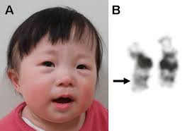 Clinical Information Of The Patient A The Patient Shows Facial Download Scientific Diagram