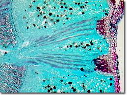 Stinging and burning can occur in the mouth of a predator who has eaten a raphide crystal, and esophageal. Molecular Expressions Science Optics You Olympus Mic D Brightfield Gallery Druse Crystals