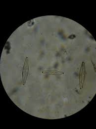 Domain Eukarya Kingdom Protista Phylum Bacillariophyta Flashcards Quizlet