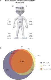 Image result for Rest Tremor