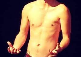 10 Facts About Poland Syndrome Stott Collaborate Listen