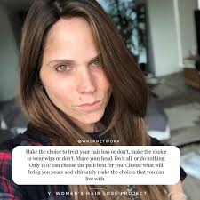 Actually, there are many male celebrities suffering from hair loss. The Women S Hair Loss Project Posts Facebook