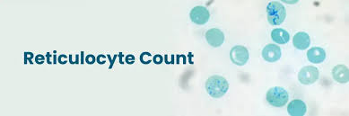 Image result for Reticulocyte Count
