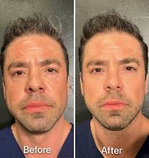 Danielle Cota-Robles RN, BSN (@dani.aesthetics.az) • Instagram photos and  videos