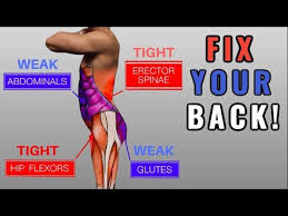 Fix Anterior Pelvic Tilt In 10 Minutes Day Daily Exercise Routine Youtube Daily Exercise Routines Daily Workout Workout Routine