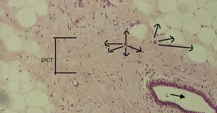 The main cell type for this tissue is the fibroblast (which 'builds' the fibers) Dense Irregular Connective Tissue 10x Histology