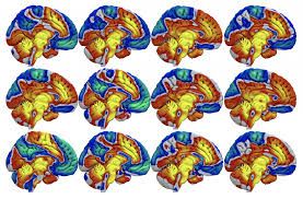 Imaginganatomy.com is an interactive atlas of normal imaging anatomy for the radiologist as well as a the atlas mimics a radiological workstation (pacs) and includes anatomy as it presents itself on. Dbs Network Mapping Lead Dbs