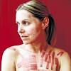 Dermatologist has proven the device can reduce 75% of hair in as little as 3 treatments. 1