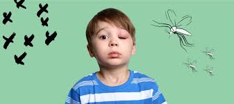 Image result for mosquito bite