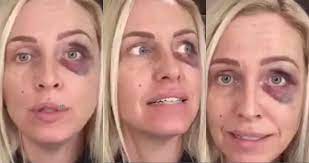 The big brother winner took to social media today to announce the happy news that she had welcomed her first child with boyfriend terry. Josie Gibson Boyfriend Who Is The Big Brother Star S Ex Partner Terry Everything You Need To Know About The Father Of Her Child Ok Magazine